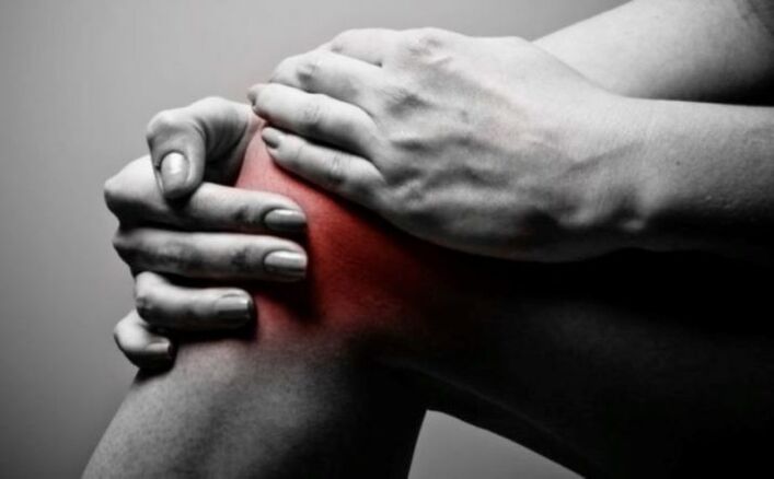 Arthritis of the knee joint