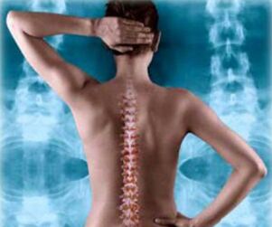 Illustration of the posterior spine