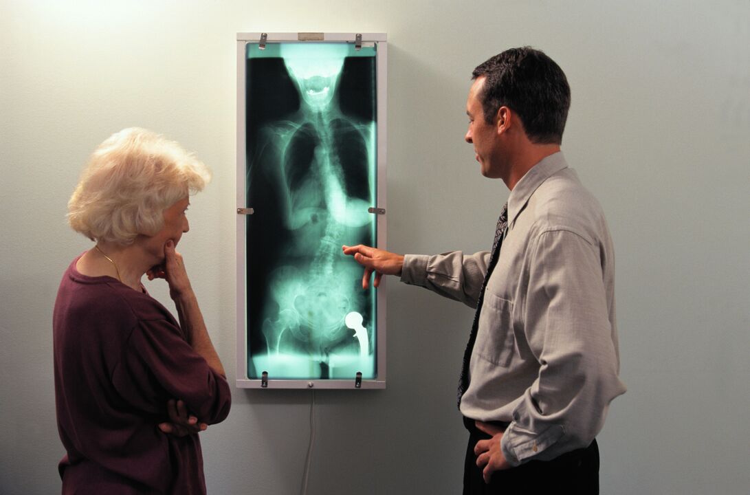 X-ray diagnostics for pain in the hip joint